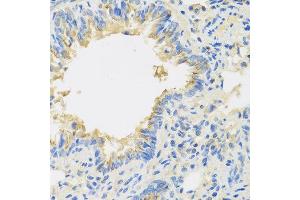Immunohistochemistry of paraffin-embedded mouse lung using IL22 antibody at dilution of 1:100 (40x lens). (IL-22 anticorps)