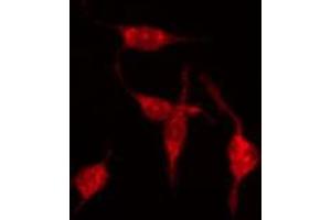 ABIN6273889 staining Hela by IF/ICC. (GPR68 anticorps  (Internal Region))
