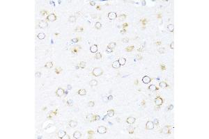 Immunohistochemistry of paraffin-embedded rat brain using DN antibody (ABIN6127810, ABIN6139703, ABIN6139704 and ABIN6216724) at dilution of 1:100 (40x lens). (DNAJB11 anticorps  (AA 89-358))