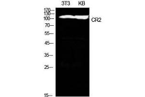 Western Blot (WB) analysis of NIH-3T3, KB cells using CD21 Polyclonal Antibody. (CD21 anticorps  (Internal Region))