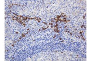 Image no. 3 for anti-Ribophorin II (RPN2) antibody (ABIN1500757)