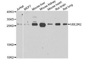 Western blot analysis of extracts of various cell lines, using UBE2R2 antibody. (UBE2R2 anticorps  (AA 1-238))