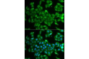 Immunofluorescence analysis of A549 cells using ANXA11 antibody. (Annexin A11 anticorps  (AA 276-505))