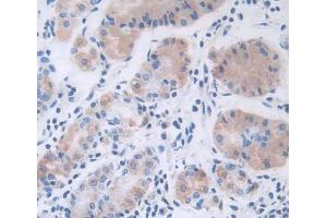 Used in DAB staining on fromalin fixed paraffin- embedded stomach tissue (Leptin anticorps  (AA 22-167))