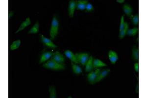 Immunofluorescence staining of Hela cells with ABIN7145566 at 1:200, counter-stained with DAPI. (EPRS anticorps  (AA 1207-1399))