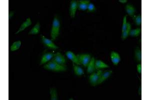 Immunofluorescence staining of Hela cells with ABIN7145566 at 1:200, counter-stained with DAPI.