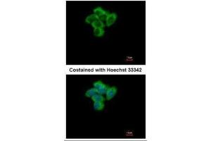 ICC/IF Image Immunofluorescence analysis of paraformaldehyde-fixed A431, using SENP2, antibody at 1:500 dilution. (SENP2 anticorps  (N-Term))