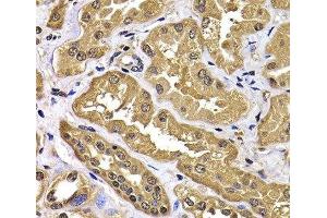 Immunohistochemistry of paraffin-embedded Human kidney using WBSCR22 Polyclonal Antibody at dilution of 1:100 (40x lens). (WBSCR22 anticorps)