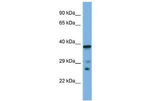 Host:  Rabbit  Target Name:  Lhx8  Sample Type:  Mouse Small Intestine lysates  Antibody Dilution:  1.