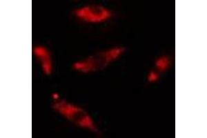 ABIN6275437 staining HuvEc cells by IF/ICC. (Rabenosyn 5 anticorps  (Internal Region))
