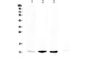 Western blot analysis of NAP2 using anti-NAP2 antibody . (CXCL7 anticorps  (AA 40-113))
