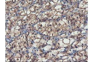 Image no. 13 for anti-phosphofructokinase, Platelet (PFKP) antibody (ABIN1500164)