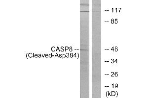 Western blot analysis of extracts from 293 cells, treated with etoposide (25uM, 1hour), using CASP8 (Cleaved-Asp384) antibody. (Caspase 8 anticorps  (Cleaved-Asp384))