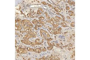 IHC analysis of Mitochondrial Dicarboxylate Carrier/SLC25A10 using anti-Mitochondrial Dicarboxylate Carrier/SLC25A10 antibody (ABIN7601497).