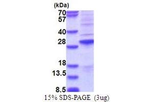 SDS-PAGE (SDS) image for Synovial Sarcoma, X Breakpoint 2 (SSX2) (AA 1-188) protein (His tag) (ABIN6387445)