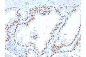 Ret Proto-Oncogene Antikörper  (AA 702-848)