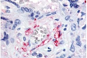 Human Placenta, Fetal Capillary Endothelial Cells (formalin-fixed, paraffin-embedded) stained with FLT1 antibody ABIN213617 at 5-10 ug/ml followed by biotinylated goat anti-rabbit IgG secondary antibody ABIN481713, alkaline phosphatase-streptavidin and chro . (FLT1 anticorps  (N-Term))