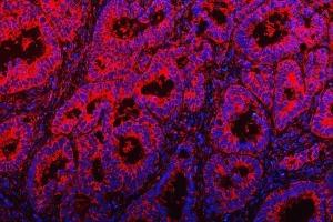 IF analysis of TOM1L1 using anti-TOM1L1 antibody (ABIN7602631). (TOM1L1 anticorps  (AA 9-448))