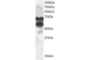 Image no. 1 for anti-Protein Phosphatase 2, Regulatory Subunit B', delta (PPP2R5D) (C-Term) antibody (ABIN374132) (PPP2R5D anticorps  (C-Term))