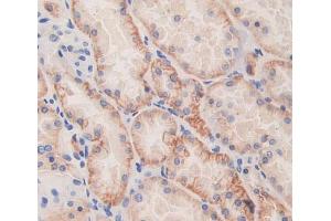 Used in DAB staining on fromalin fixed paraffin- embedded Kidney tissue (SRP9 anticorps  (AA 2-86))