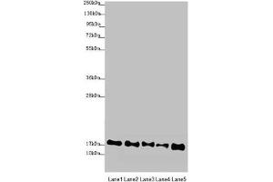 Western blot All lanes: ATP5F1D antibody at 2. (ATP5F1D anticorps  (AA 1-168))