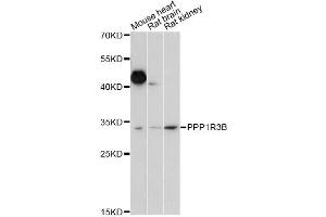 Western blot analysis of extracts of various cell lines, using PPP1R3B antibody (ABIN6293886) at 1:1000 dilution. (PPP1R3B anticorps)
