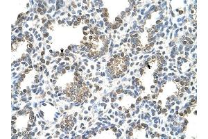 TST antibody was used for immunohistochemistry at a concentration of 4-8 ug/ml to stain Alveolar cells (arrows) in Human Lung. (TST anticorps)
