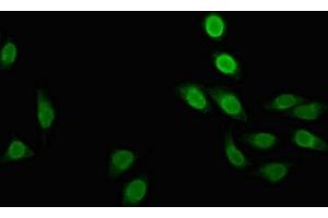 Immunofluorescent analysis of A549 cells using ABIN7150418 at dilution of 1:100 and Alexa Fluor 488-congugated AffiniPure Goat Anti-Rabbit IgG(H+L) (POLR2M anticorps  (AA 2-91))