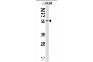 Western blot analysis in Jurkat cell line lysates (35ug/lane). (C1RL anticorps  (AA 161-190))