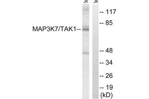 Western blot analysis of extracts from Jurkat cells, treated with heat shock, using MAP3K7 (epitope around residue 187) antibody.