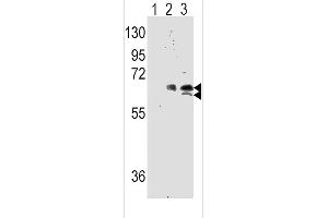 Western blot analysis of Phospho-RPS6KB1-pS424 Antibody (AP3352a) and RPS6KB1 Antibody (S424) (AP3289g) in human TNF alpha activated Hela cell line lysates.