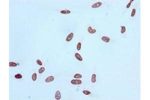 Immunocytochemistry analysis of ABIN7127270 diluted at 1:100 and staining in Hela cells performed on a Leica BondTM system.