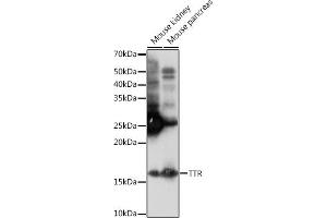 Western blot analysis of extracts of various cell lines, using TTR Rabbit mAb (ABIN1682449, ABIN3018489, ABIN3018490 and ABIN7101619) at 1:1000 dilution. (TTR anticorps)