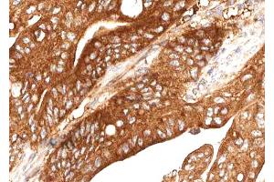 ABIN6268729 at 1/100 staining human Stomach tissue sections by IHC-P. (Cathepsin E anticorps  (Internal Region))