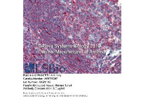 Immunohistochemistry (IHC) image for anti-Phosphatase and Actin Regulator 1 (PHACTR1) (Middle Region) antibody (ABIN2786181)