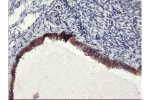 Immunohistochemical staining of paraffin-embedded Human Ovary tissue using anti-FBXO21 mouse monoclonal antibody.