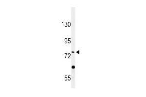 Western blot analysis of PLA2G6 Antibody (Center) (ABIN653895 and ABIN2843138) in HepG2 cell line lysates (35 μg/lane). (PLA2G6 anticorps  (AA 551-580))