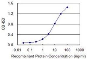 Detection limit for recombinant GST tagged EXOSC3 is 0.