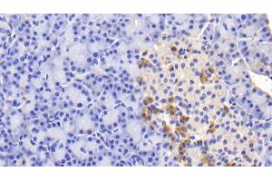 anti-Insulin Receptor (INSR) (AA 1024-1298) antibody