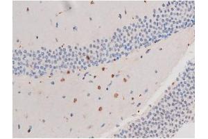 ABIN6267485 at 1/200 staining Mouse brain tissue sections by IHC-P.