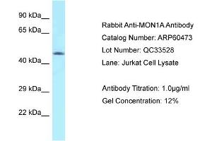 Western Blotting (WB) image for anti-MON1 Homolog A (MON1A) (N-Term) antibody (ABIN2788457)