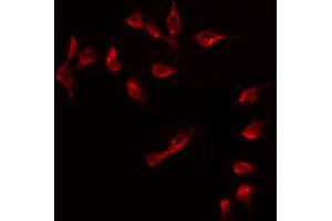 ABIN6274920 staining COLO205 by IF/ICC.