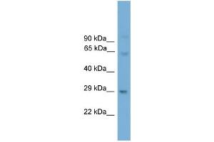 WB Suggested Anti-Prrx2 Antibody Titration:  0. (PRRX2 anticorps  (N-Term))