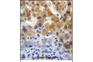 NT5C3L Antibody (N-term) (ABIN657206 and ABIN2846319) immunohistochemistry analysis in formalin fixed and paraffin embedded human liver tissue followed by peroxidase conjugation of the secondary antibody and DAB staining. (NT5C3L anticorps  (N-Term))
