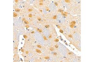 Immunohistochemistry of paraffin embedded rat brain using erf1 (ABIN7073895) at dilution of 1: 2400 (400x lens)