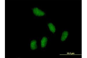 Immunofluorescence of purified MaxPab antibody to KCTD15 on HeLa cell. (KCTD15 anticorps  (AA 1-234))