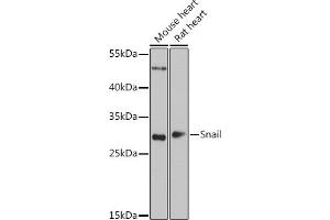 Western blot analysis of extracts of various cell lines, using Snail antibody (ABIN6132675, ABIN6148177, ABIN6148180 and ABIN6221190) at 1:1000 dilution.