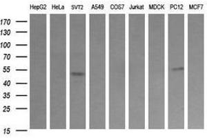 Image no. 1 for anti-Tripartite Motif Containing 38 (TRIM38) (AA 1-265) antibody (ABIN1490689) (TRIM38 anticorps  (AA 1-265))