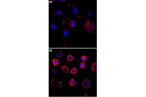 Immunocytochemistry staining of serum-starved A431 cells (A) and serum-starved A431 cells treated with EGF (B) using Phosphotyrosine monoclonal antibody, clone RM111  (Red) at 1:500 dilution. (Phosphotyrosine anticorps)