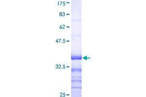 Image no. 1 for ATPase, Cu++ Transporting, alpha Polypeptide (ATP7A) (AA 1406-1500) protein (GST tag) (ABIN1346155)